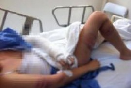  Polisler tarafından dövülen Türk öğrenci sosyal paylaşım sitesi Twitter'dan yaşadıklarını paylaştı (foto)